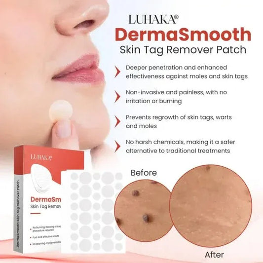 DermaSmooth Skin Tag Remover Patch – Fast, Safe, And Painless Skin Tag And Mole Removal Solution With No Scarring Or Pigmentation
